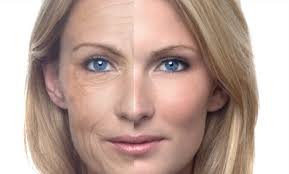 Surprising ways to get rid of wrinkles